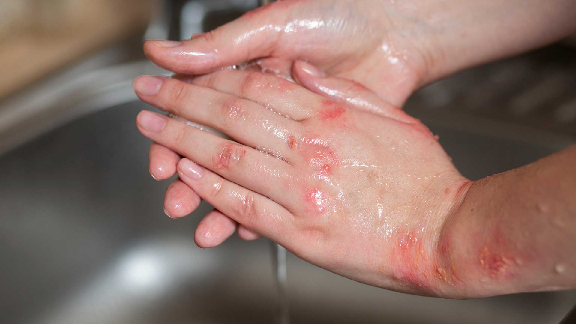 Background image for Obsessive Compulsive Disorder (OCD) Hypnotherapy